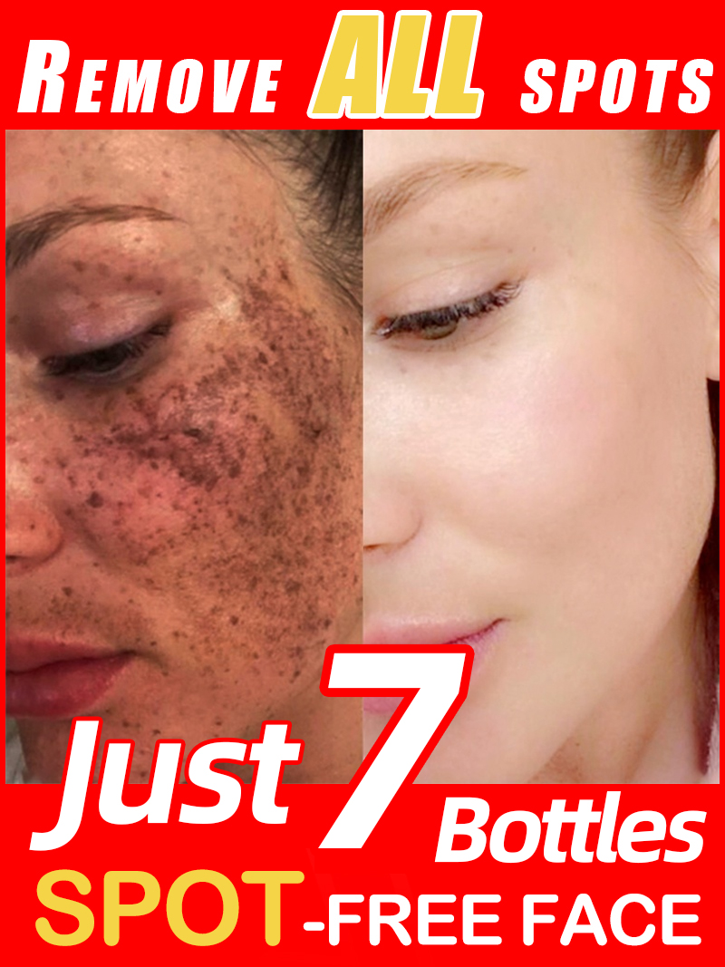 Mencerahkan Bintik-Bintik, Mel - Luxury Skincare Essence ulasan dan harga